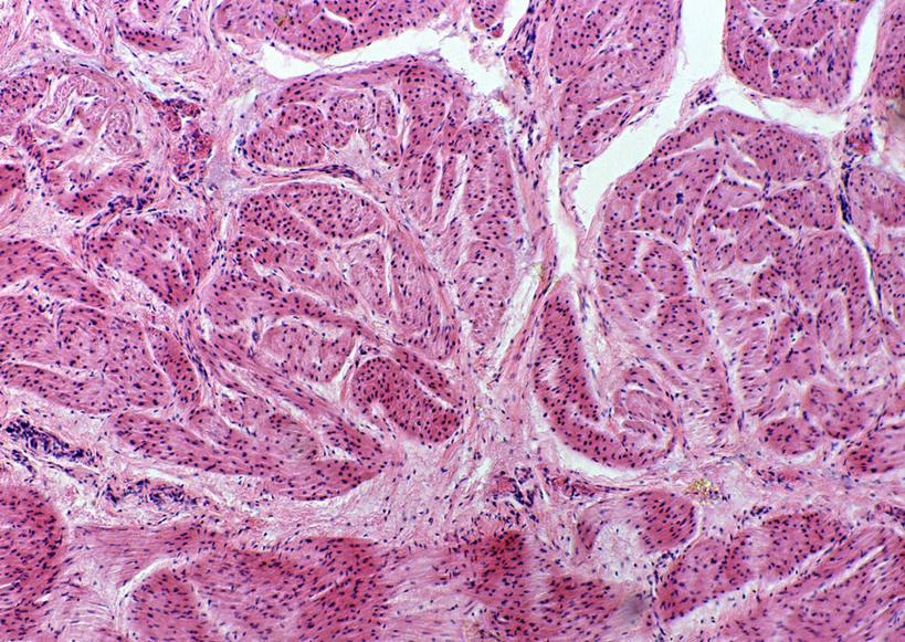 无人,横图,俯视,室内,特写,白天,仪器,微生物,许多,检查,反射,分析,科学,医学,圆形,细胞,显微镜,很多,粉色,白色,观察,清晰,探索,放大,观看,仔细,透镜,生物学,凸透镜,聚焦,关注,光学,清楚,平滑肌,显微图片,彩图,高角度拍摄,肌肉细胞,肌细胞