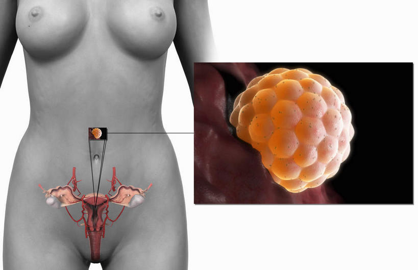 胸,动脉,静脉,骨骼,卵巢,阴道,无人,站,横图,插画,室内,特写,白天,白色背景,正面,数码,科技,静物,阴影,网络,医学,骨头,高光,几何,计算机图形,合成,图画,裸露,画,模型,站着,人体,赤裸,电脑合成图,数码合成图,骨架,生物学,卵子,裸,漫画,生理学,写实,具体,具象,卵,宫颈,子宫肌层,子宫颈,胸部,站立,半身,彩图,生殖系统,受精卵