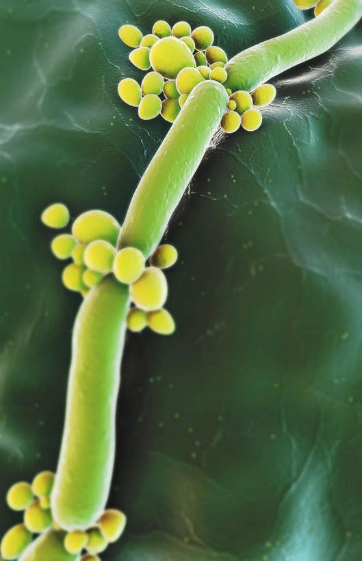 无人,竖图,插画,室内,白天,正面,数码,科技,静物,阴影,网络,医学,高光,几何,计算机图形,合成,图画,画,黄色,绿色,生物,人体,电脑合成图,数码合成图,医疗,生物学,真菌,漫画,生理学,写实,具体,具象,酵母,真菌感染性口炎,彩图