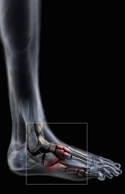 动脉,静脉,骨骼,无人,竖图,插画,x光片,室内,白天,正面,数码,科技,静物,阴影,黑色背景,辐射,科学,网络,医学,骨头,高光,几何,计算机图形,合成,图画,画,模型,人体,电脑合成图,数码合成图,骨架,医疗,生物学,科学技术,x射线,x光,漫画,生理学,写实,具体,具象,髌骨,腓骨,跗骨,胫骨,趾骨,半身,彩图,电磁波,电磁辐射