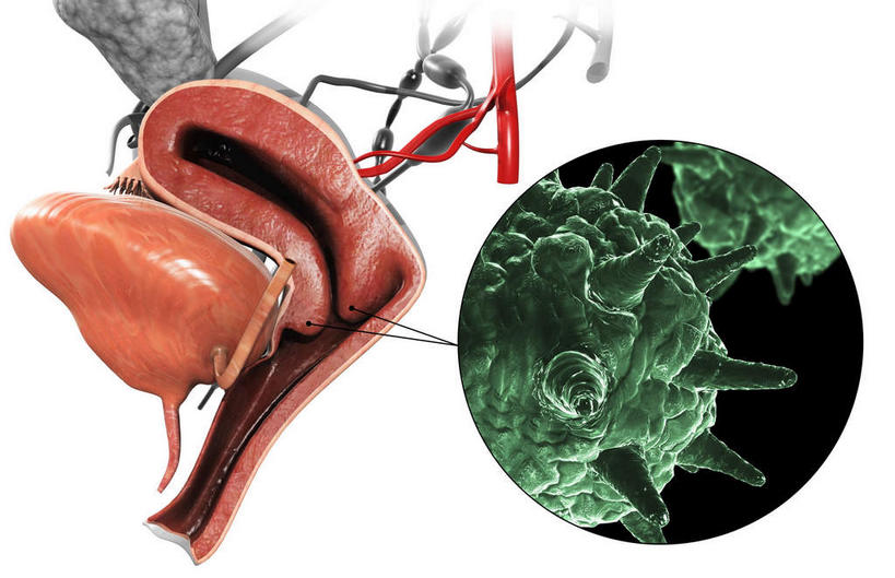 阴道,无人,横图,插画,室内,白天,白色背景,正面,数码,科技,阴影,网络,医学,高光,几何,计算机图形,合成,图画,画,绿色,生物,电脑合成图,数码合成图,医疗,生物学,漫画,写实,具体,具象,DNA病毒,疱疹,疱疹病毒,彩图,生殖器官,生殖系统