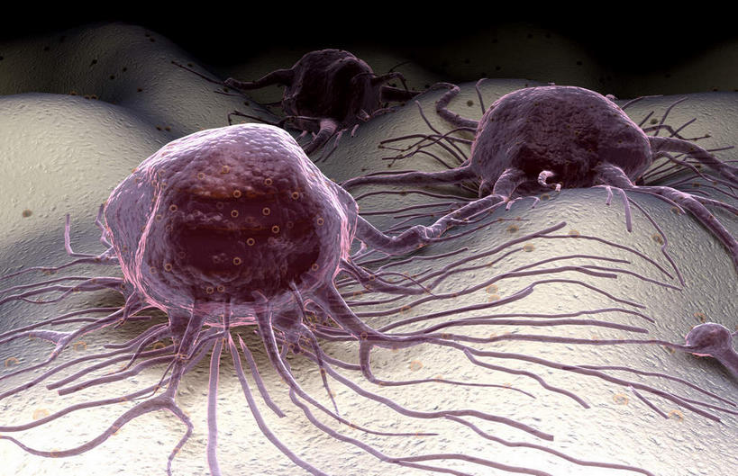 无人,横图,插画,室内,白天,正面,数码,科技,静物,阴影,网络,医学,高光,几何,计算机图形,合成,图画,画,灰色,生物,人体,电脑合成图,数码合成图,医疗,生物学,漫画,癌症,癌细胞,生理学,写实,具体,具象,彩图