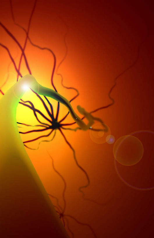 无人,竖图,插画,室内,白天,正面,数码,科技,微生物,静物,阴影,网络,医学,高光,几何,计算机图形,合成,图画,画,黄色,生物,人体,电脑合成图,数码合成图,医疗,生物学,漫画,神经元,生理学,写实,具体,具象,树突,寄生,生命体,运动神经元,轴突,彩图,神经系统