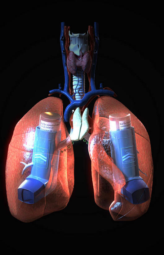内脏,肺,脊髓,动脉,静脉,骨骼,无人,竖图,插画,室内,特写,白天,正面,数码,科技,静物,阴影,黑色背景,网络,医学,骨头,高光,几何,计算机图形,合成,图画,画,两个,蓝色,模型,人体,电脑合成图,数码合成图,骨架,生物学,人体器官,器官,哮喘,漫画,哮喘吸入器,生理学,写实,具体,具象,肺部,肺脏,脊柱,彩图