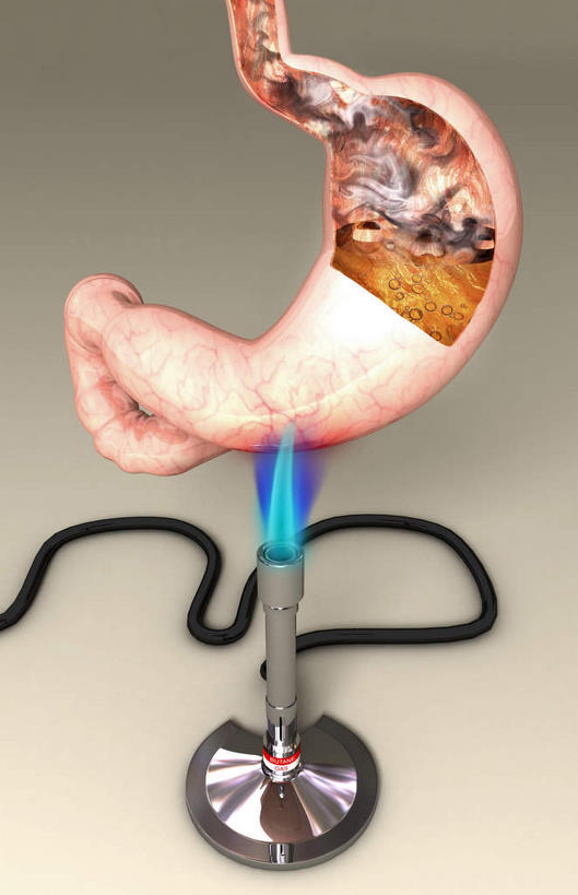 腹部,胃,无人,竖图,俯视,插画,室内,特写,白天,白色背景,烧烤,热情,数码,科技,桌面,火,阴影,反射,网络,火焰,影子,高光,几何,计算机图形,燃烧,合成,图画,画,一个,蓝色,单个,电脑合成图,数码合成图,医疗设备,医疗器械,漫画,本生灯,写实,具体,具象,胃部,彩图,高角度拍摄