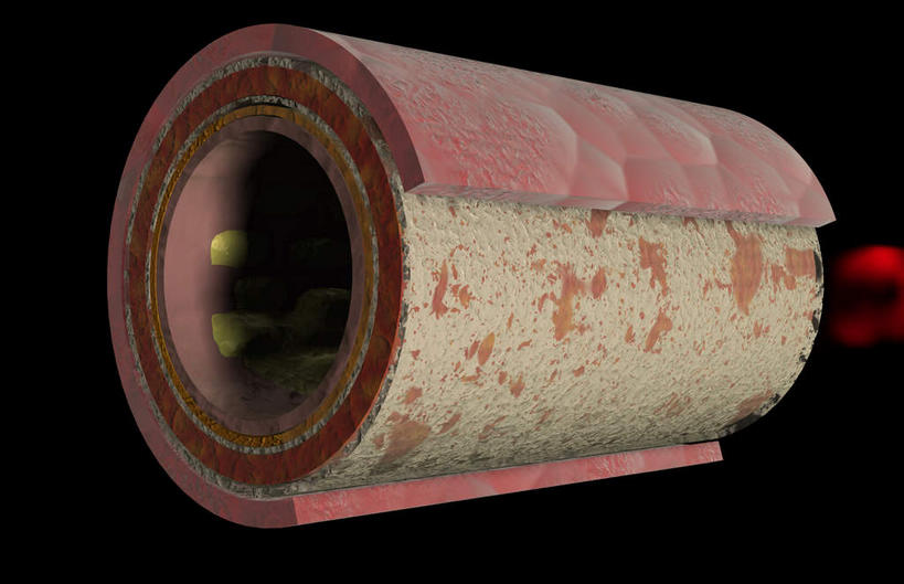 血管,无人,横图,插画,室内,特写,白天,正面,数码,科技,阴影,黑色背景,网络,医学,膜,高光,几何,计算机图形,合成,图画,画,血液,电脑合成图,数码合成图,生物学,漫画,生理学,写实,具体,具象,动脉管壁,内皮,彩图,血管壁