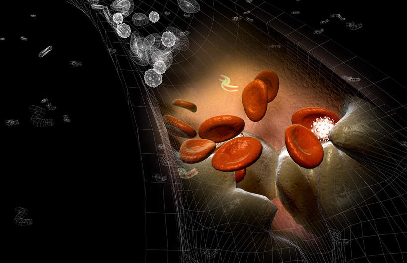 动脉,无人,横图,插画,室内,特写,白天,正面,数码,科技,阴影,黑色背景,网络,医学,高光,几何,计算机图形,合成,图画,画,血液,电脑合成图,数码合成图,疾病,生物学,漫画,生理学,写实,具体,具象,动脉硬化,动脉粥样硬化,血块,动脉管壁,彩图,血管壁