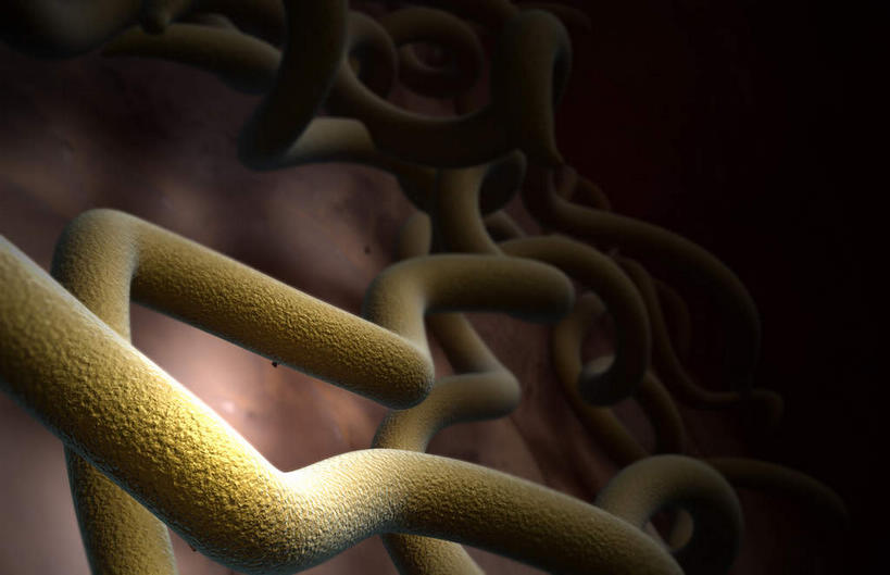 无人,横图,插画,室内,特写,白天,正面,数码,科技,微生物,静物,阴影,黑色背景,网络,细菌,医学,高光,几何,计算机图形,合成,图画,画,人体,电脑合成图,数码合成图,病毒,疾病,生物学,漫画,生理学,写实,具体,具象,寄生,生命体,生物病毒,莱姆病,彩图