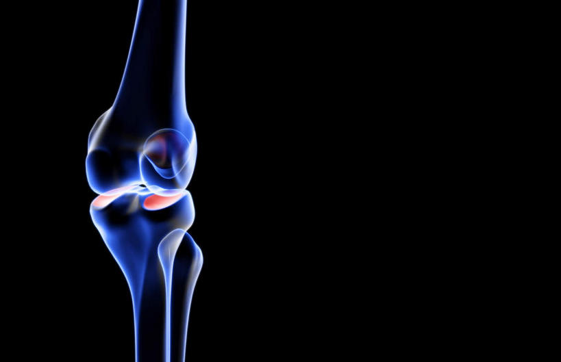 动脉,静脉,骨骼,无人,医院,横图,插画,x光片,室内,特写,白天,正面,数码,科技,静物,阴影,局部,辐射,科学,网络,医学,骨头,高光,几何,计算机图形,合成,图画,画,模型,人体,部分,电脑合成图,数码合成图,骨架,医疗,生物学,科学技术,x射线,x光,漫画,医疗机构,生理学,写实,具体,具象,髌骨,内上髁,外侧髁,外上髁,半身,彩图,病院,诊所,电磁波,电磁辐射