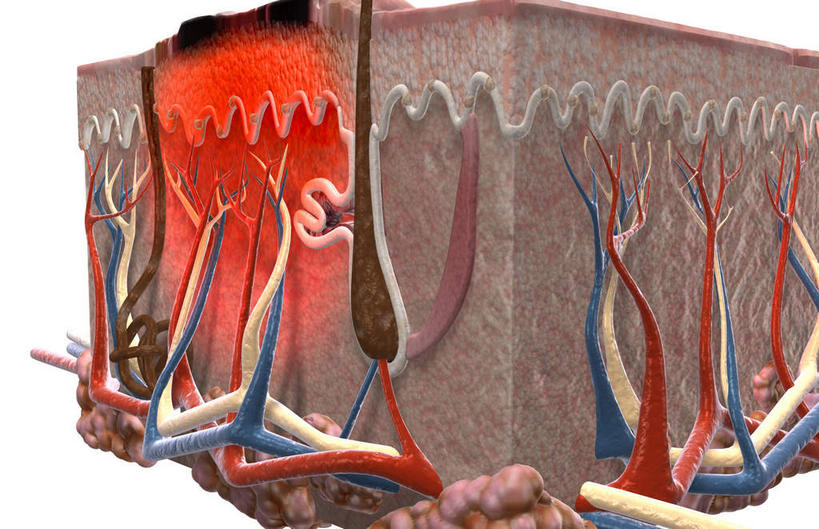 无人,横图,插画,室内,特写,白天,白色背景,正面,数码,科技,微生物,阴影,网络,医学,高光,几何,计算机图形,合成,图画,画,生物,皮肤,电脑合成图,数码合成图,医疗,病毒,生物学,肿瘤,漫画,癌症,写实,具体,具象,寄生,生命体,生物病毒,恶性肿瘤,皮肤癌,彩图,黑色素瘤