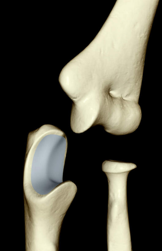 动脉,静脉,骨骼,无人,竖图,插画,室内,特写,白天,正面,数码,科技,静物,阴影,黑色背景,局部,网络,医学,骨头,高光,几何,计算机图形,合成,图画,画,模型,人体,部分,电脑合成图,数码合成图,骨架,生物学,漫画,生理学,写实,具体,具象,手肘,肘骨,半身,彩图