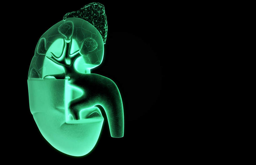 内脏,肾脏,动脉,静脉,无人,横图,插画,室内,特写,白天,正面,数码,科技,静物,阴影,黑色背景,局部,网络,医学,光芒,高光,几何,计算机图形,合成,图画,画,绿色,模型,人体,部分,电脑合成图,数码合成图,生物学,人体器官,器官,漫画,花萼,生理学,写实,具体,具象,肾窦,肾上腺,髓质,肾皮质,彩图