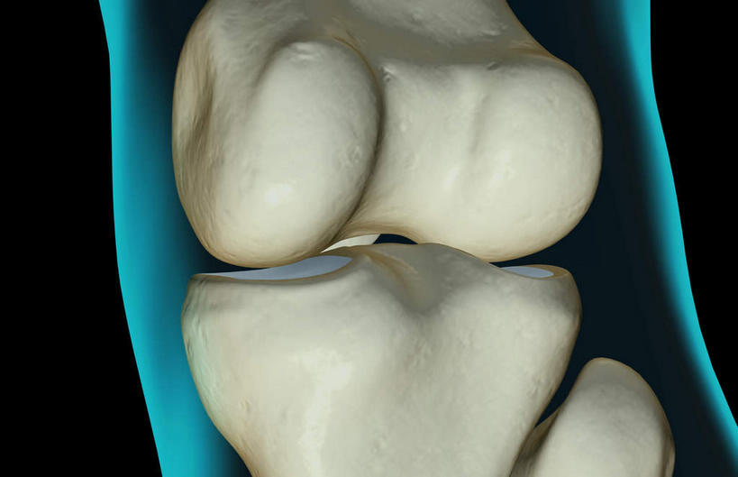 动脉,静脉,骨骼,无人,横图,插画,x光片,室内,特写,白天,正面,数码,科技,静物,阴影,黑色背景,局部,辐射,科学,网络,医学,骨头,光芒,高光,几何,计算机图形,合成,图画,画,蓝色,模型,人体,部分,电脑合成图,数码合成图,骨架,医疗,生物学,科学技术,x射线,x光,漫画,生理学,写实,具体,具象,髌骨,内上髁,外上髁,半身,彩图,电磁波,电磁辐射