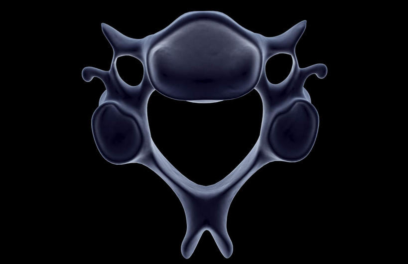 动脉,静脉,骨骼,无人,横图,插画,x光片,室内,特写,白天,正面,数码,科技,静物,阴影,黑色背景,局部,辐射,科学,网络,医学,骨头,光芒,高光,几何,计算机图形,合成,图画,画,模型,人体,部分,电脑合成图,数码合成图,骨架,医疗,生物学,科学技术,x射线,x光,漫画,生理学,写实,具体,具象,颈椎,颈椎横突,半身,彩图,电磁波,电磁辐射