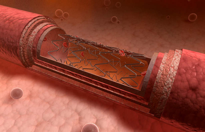 内脏,肠,动脉,静脉,血管,十二指肠,无人,横图,插画,室内,白天,白色背景,正面,数码,科技,静物,阴影,网络,医学,高光,几何,计算机图形,合成,图画,画,模型,人体,电脑合成图,数码合成图,生物学,人体器官,器官,漫画,生理学,写实,具体,具象,动脉硬化,动脉粥样硬化,血管病,彩图