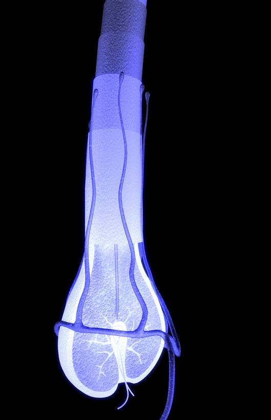 头发,无人,竖图,插画,室内,白天,正面,数码,科技,静物,阴影,黑色背景,网络,医学,高光,几何,计算机图形,合成,图画,画,人体,电脑合成图,数码合成图,生物学,漫画,生理学,写实,具体,具象,毛囊,彩图