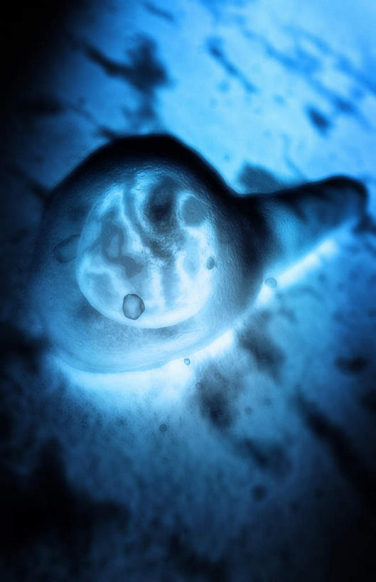 无人,竖图,插画,室内,白天,白色背景,正面,数码,科技,静物,阴影,网络,医学,细胞,高光,几何,计算机图形,合成,图画,画,人体,电脑合成图,数码合成图,疾病,生物学,漫画,生理学,写实,具体,具象,传染,破伤风杆菌,破伤风,彩图,杆状体