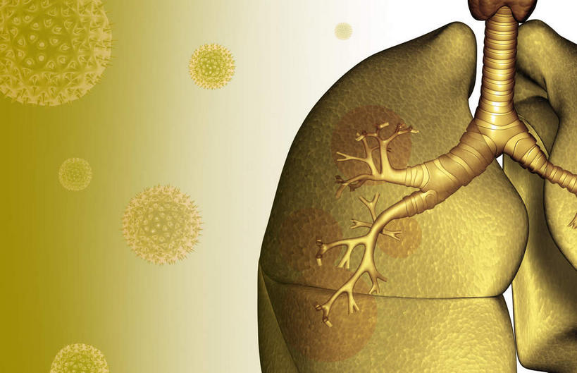 内脏,肺,无人,横图,插画,室内,白天,正面,数码,分子,科技,微生物,静物,阴影,网络,细菌,医学,高光,几何,计算机图形,合成,图画,画,生物,电脑合成图,数码合成图,医疗,生物学,器官,哮喘,漫画,花粉,过敏,生理学,写实,具体,具象,过敏反应,呼吸系统,寄生,生命体,花粉症,过敏症,肺部,肺脏,彩图