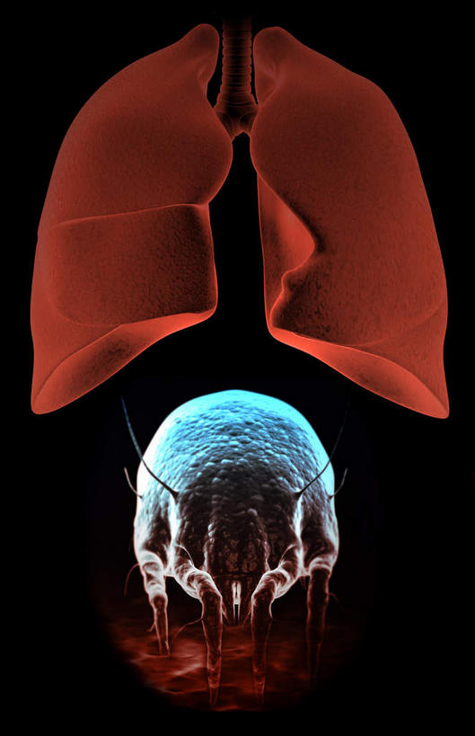 内脏,肺,无人,竖图,插画,室内,白天,正面,数码,科技,静物,阴影,黑色背景,微小,网络,细菌,医学,高光,几何,计算机图形,合成,图画,画,一只,动物,人体,电脑合成图,数码合成图,生物学,器官,漫画,病菌,生理学,写实,具体,具象,传染,寄生,寄生虫,螨虫,尘螨,肺部,肺脏,彩图,微弱