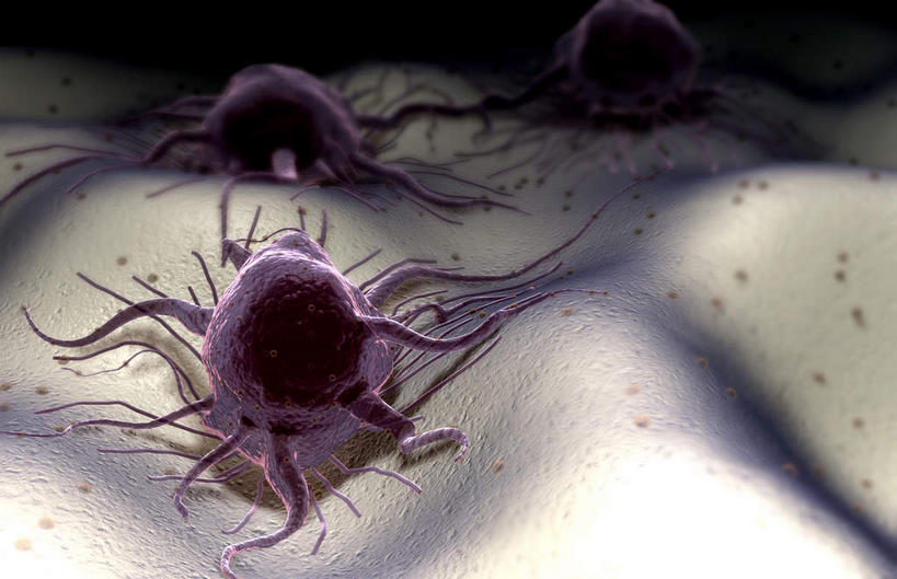 无人,横图,插画,室内,特写,白天,正面,数码,分子,科技,微生物,静物,阴影,黑色背景,网络,医学,高光,几何,计算机图形,合成,图画,画,生物,人体,电脑合成图,数码合成图,医疗,病毒,生物学,漫画,癌症,癌细胞,生理学,写实,具体,具象,寄生,生命体,肿瘤细胞,彩图