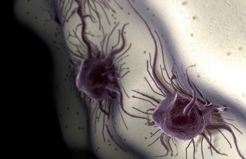 无人,横图,插画,室内,特写,白天,正面,数码,分子,科技,微生物,静物,阴影,黑色背景,网络,医学,高光,几何,计算机图形,合成,图画,画,生物,人体,电脑合成图,数码合成图,医疗,病毒,生物学,漫画,癌症,癌细胞,生理学,写实,具体,具象,寄生,生命体,肿瘤细胞,彩图