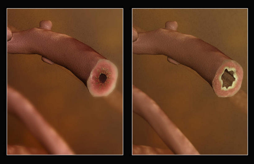 无人,横图,插画,室内,特写,白天,正面,数码,科技,静物,阴影,黑色背景,网络,医学,高光,几何,计算机图形,合成,图画,画,人体,电脑合成图,数码合成图,生物学,哮喘,漫画,过敏,支气管,生理学,写实,具体,具象,细支气管,呼吸系统,彩图