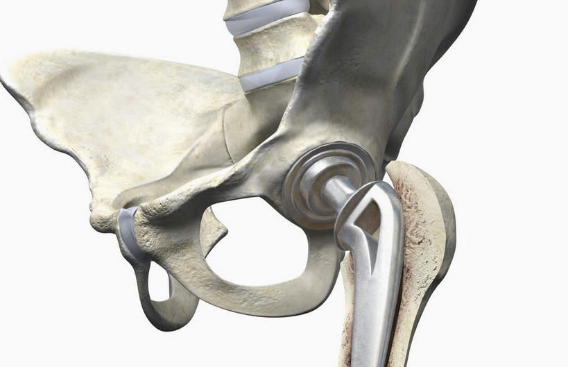 动脉,静脉,骨骼,无人,横图,插画,室内,特写,白天,白色背景,正面,数码,科技,静物,阴影,网络,医学,骨头,高光,几何,计算机图形,合成,图画,画,模型,人体,电脑合成图,数码合成图,骨架,生物学,漫画,生理学,写实,具体,具象,髋关节,半身,彩图