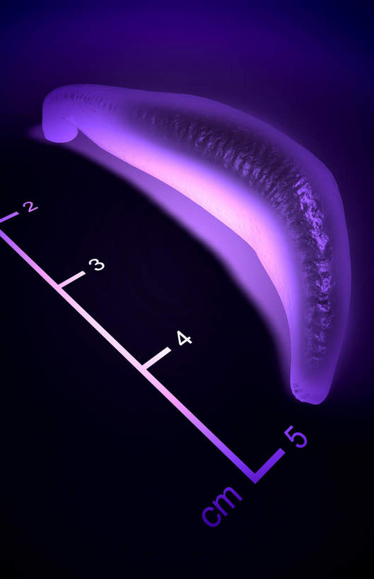 无人,竖图,x光片,室内,特写,白天,正面,静物,不锈钢,蓝色背景,辐射,科学,医学,测量,不锈钢制品,刻度,紫色,尺,直尺,人体,钢尺,测量工具,尺子,医疗,生物学,衡量,科学技术,绘图,x射线,水生动物,x光,水生物,比例,测绘,生理学,量具,量仪,标度,蚂蟥,水蛭,彩图,电磁波,电磁辐射
