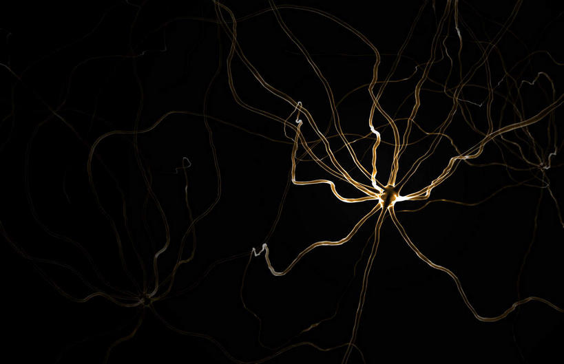 神经,无人,横图,插画,室内,特写,白天,正面,数码,科技,静物,阴影,黑色背景,网络,医学,细胞,高光,几何,计算机图形,合成,图画,画,红色,人体,电脑合成图,数码合成图,生物学,漫画,神经元,生理学,写实,具体,具象,轴突,彩图,神经系统,神经组织