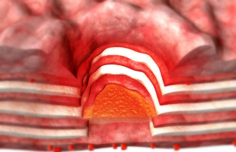 内脏,动脉,静脉,无人,横图,插画,室内,白天,白色背景,正面,数码,科技,静物,阴影,网络,医学,高光,几何,计算机图形,合成,图画,画,红色,模型,粘液,人体,电脑合成图,数码合成图,生物学,人体器官,器官,漫画,生理学,写实,具体,具象,溃疡,浆膜,粘膜下层,彩图,胃溃疡,消化系统