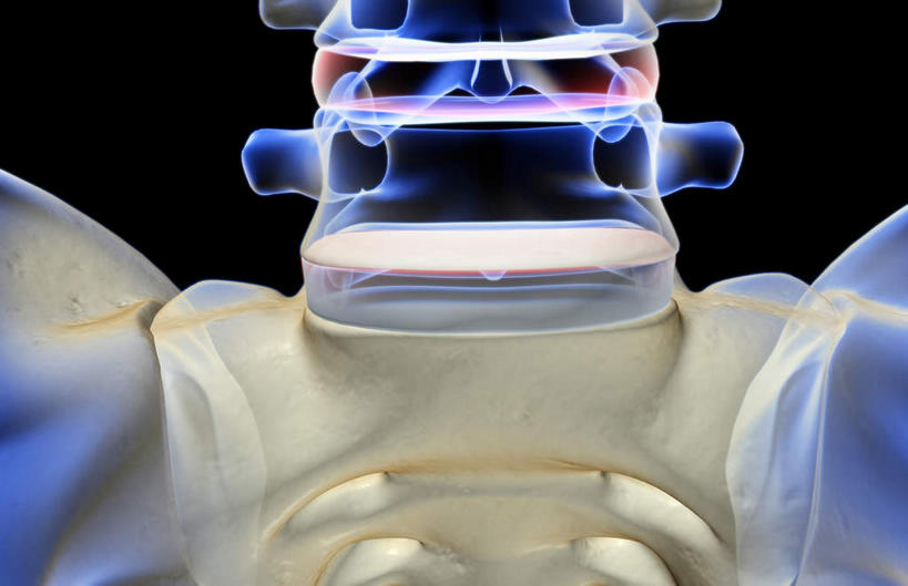 脊髓,无人,横图,插画,x光片,室内,特写,白天,正面,数码,科技,阴影,黑色背景,辐射,科学,网络,医学,高光,几何,计算机图形,合成,图画,画,电脑合成图,数码合成图,医疗,科学技术,x射线,x光,漫画,写实,具体,具象,腰椎,脊柱,彩图,电磁波,电磁辐射