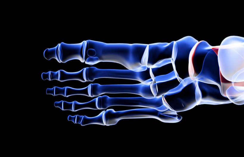 腿部,脚,脚趾,脚趾甲,腿,无人,横图,插画,x光片,室内,白天,正面,数码,科技,阴影,黑色背景,辐射,科学,网络,医学,高光,几何,计算机图形,合成,图画,画,电脑合成图,数码合成图,医疗,科学技术,x射线,x光,漫画,写实,具体,具象,距骨,手舟骨,跖骨,脚指甲,彩图,电磁波,电磁辐射