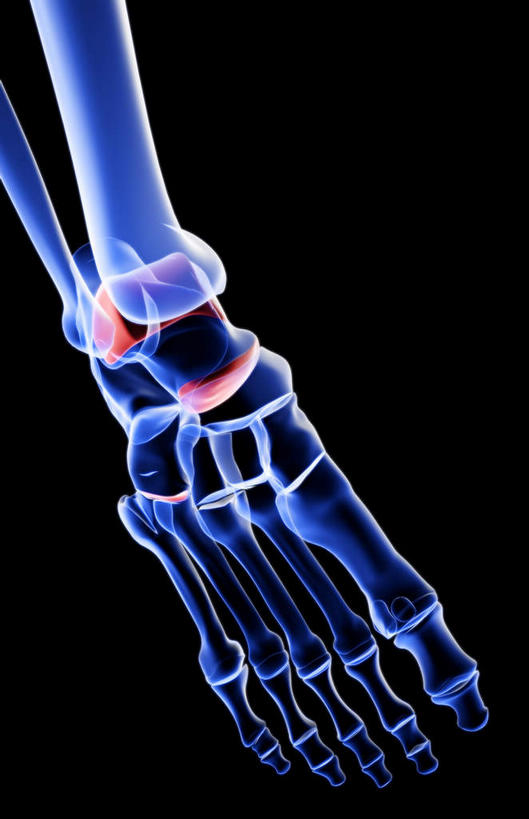 腿部,脚,脚趾,脚趾甲,动脉,静脉,骨骼,腿,无人,横图,插画,x光片,室内,白天,正面,数码,科技,静物,阴影,黑色背景,发光,辐射,科学,网络,医学,骨头,高光,几何,计算机图形,合成,图画,画,紫色,模型,人体,电脑合成图,数码合成图,骨架,医疗,生物学,科学技术,x射线,x光,漫画,生理学,写实,具体,具象,手舟骨,跖骨,脚指甲,彩图,电磁波,电磁辐射