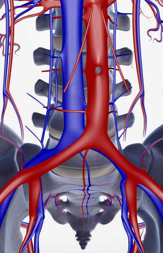 骨骼,无人,竖图,x光片,室内,白天,白色背景,正面,数码,科技,阴影,辐射,科学,网络,医学,骨头,高光,几何,计算机图形,合成,电脑合成图,数码合成图,骨架,医疗,科学技术,x射线,x光,写实,具体,具象,腹主动脉,髂动脉,髂静脉,髂外动脉,髂外静脉,腰椎,半身,彩图,电磁波,电磁辐射