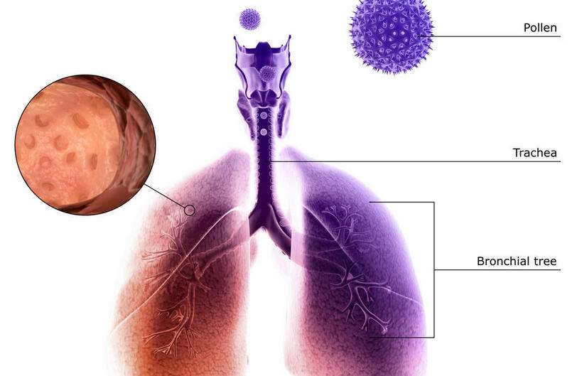 无人,横图,插画,室内,特写,白天,白色背景,正面,数码,科技,静物,阴影,网络,医学,英文,标志,文字,细胞,字符,字母,高光,几何,计算机图形,合成,图画,标识,画,解说,人体,说明,英文字母,电脑合成图,数码合成图,生物学,哮喘,漫画,花粉,过敏,生理学,写实,具体,具象,过敏反应,阐明,申明,注解,注明,花粉症,彩图