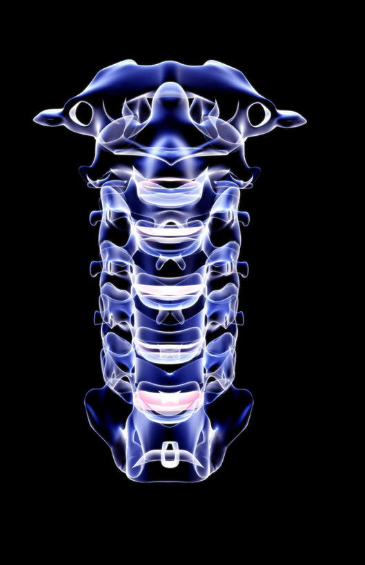 骨骼,无人,横图,x光片,室内,白天,正面,数码,科技,阴影,黑色背景,发光,辐射,科学,网络,医学,骨头,高光,几何,计算机图形,合成,蓝色,电脑合成图,数码合成图,骨架,医疗,科学技术,x射线,x光,写实,具体,具象,颈椎,腰椎,彩图,电磁波,电磁辐射
