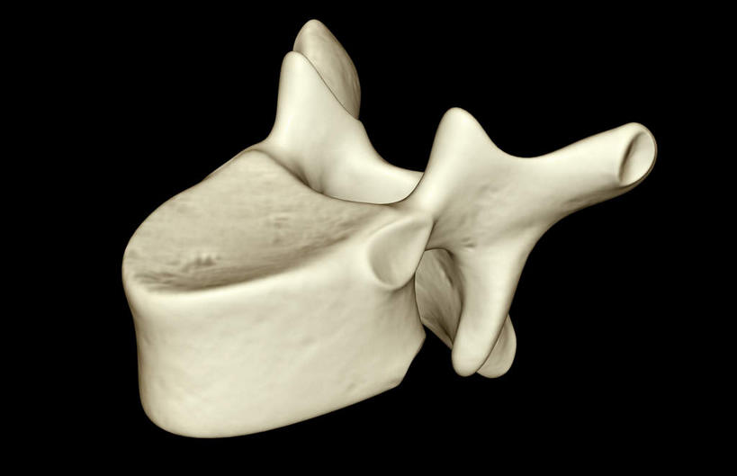 脊髓,骨骼,无人,横图,x光片,室内,白天,正面,数码,科技,阴影,黑色背景,辐射,科学,网络,医学,骨头,高光,几何,计算机图形,合成,电脑合成图,数码合成图,骨架,医疗,科学技术,x射线,x光,写实,具体,具象,腰椎,横突,脊柱,彩图,电磁波,电磁辐射