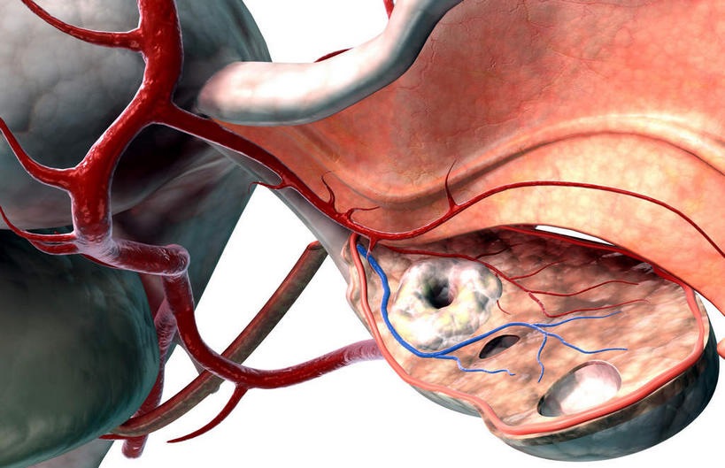 卵巢,无人,横图,插画,室内,特写,白天,白色背景,正面,数码,科技,静物,阴影,网络,医学,细胞,高光,几何,计算机图形,合成,图画,画,人体,电脑合成图,数码合成图,生物学,解剖,漫画,生理学,写实,具体,具象,彩图,剖解