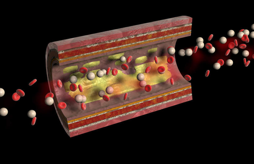 内脏,动脉,静脉,血管,无人,横图,室内,特写,白天,正面,数码,科技,静物,阴影,黑色背景,网络,医学,高光,几何,计算机图形,合成,红色,模型,人体,电脑合成图,数码合成图,疾病,生物学,人体器官,器官,生理学,写实,具体,具象,动脉硬化,动脉粥样硬化,血管病,彩图
