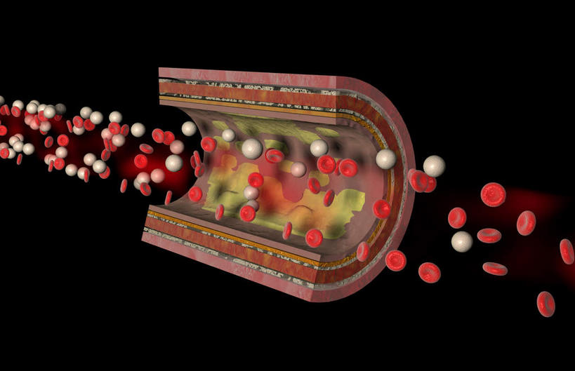 内脏,动脉,静脉,无人,横图,室内,特写,白天,正面,数码,科技,静物,阴影,黑色背景,网络,医学,高光,几何,计算机图形,合成,红色,模型,人体,电脑合成图,数码合成图,生物学,人体器官,器官,生理学,写实,具体,具象,动脉硬化,动脉粥样硬化,血管病,彩图