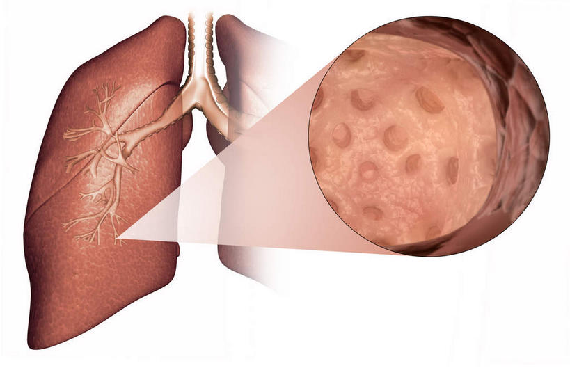 内脏,肝脏,动脉,静脉,无人,横图,插画,室内,白天,白色背景,正面,数码,科技,静物,阴影,网络,医学,高光,几何,计算机图形,合成,图画,画,模型,人体,电脑合成图,数码合成图,生物学,人体器官,器官,哮喘,漫画,生理学,写实,具体,具象,囊泡,肝,彩图