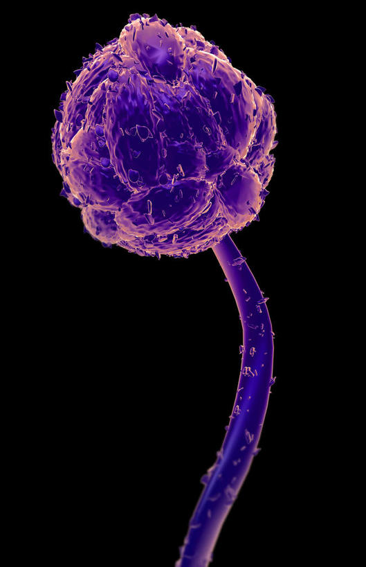 无人,竖图,插画,室内,特写,白天,正面,数码,分子,科技,微生物,阴影,黑色背景,网络,医学,高光,几何,计算机图形,合成,图画,画,紫色,生物,电脑合成图,数码合成图,医疗,病毒,生物学,孢子,漫画,写实,具体,具象,寄生,生命体,胞子,霉菌毒素,彩图