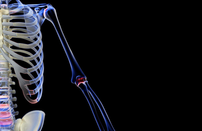 神经,动脉,静脉,骨骼,肋骨,脊椎,无人,横图,插画,x光片,室内,特写,白天,正面,数码,科技,静物,阴影,黑色背景,辐射,科学,网络,医学,骨头,高光,几何,计算机图形,合成,图画,画,红色,蓝色,白色,模型,人体,电脑合成图,数码合成图,骨架,医疗,生物学,科学技术,x射线,x光,漫画,生理学,写实,具体,具象,肱骨,髋骨,桡骨,半身,彩图,神经系统,电磁波,电磁辐射