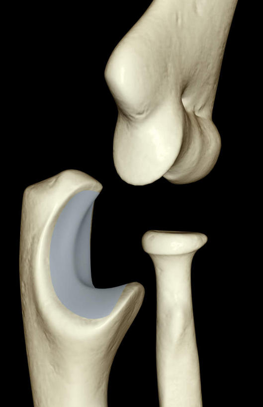 动脉,静脉,骨骼,无人,竖图,插画,x光片,室内,特写,白天,正面,数码,科技,静物,阴影,黑色背景,辐射,科学,网络,医学,支架,骨头,高光,几何,计算机图形,合成,图画,画,白色,模型,人体,电脑合成图,数码合成图,骨架,医疗,生物学,科学技术,x射线,x光,漫画,生理学,写实,具体,具象,手肘,肘部,半身,彩图,电磁波,电磁辐射