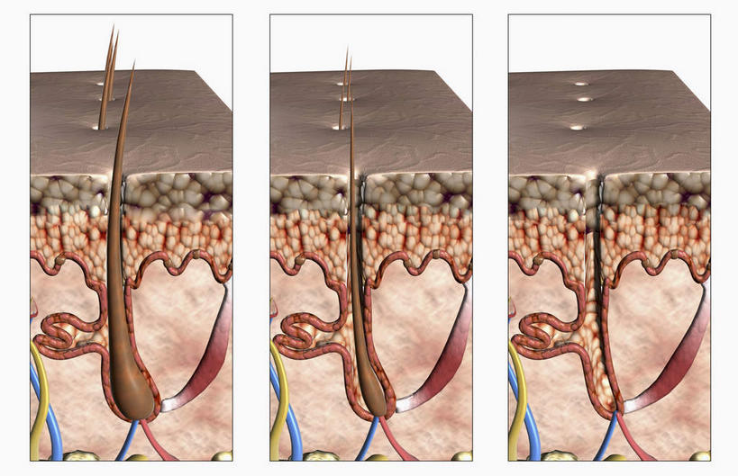 气管,神经,肌肉,血管,秃头,健壮,无人,横图,插画,室内,特写,白天,正面,数码,科技,静物,阴影,网络,医学,高光,几何,计算机图形,合成,图画,画,健康,活力,力量,人体,青春,电脑合成图,数码合成图,生物学,强壮,筋脉,漫画,生理学,写实,具体,具象,毛囊,头皮,光头,无发,彩图