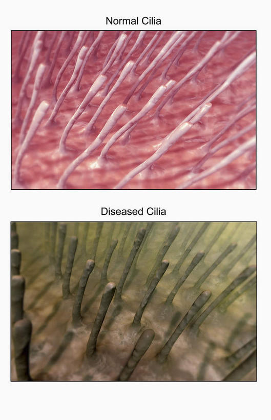内脏,动脉,静脉,无人,竖图,插画,室内,特写,白天,正面,数码,科技,静物,阴影,网络,医学,线条,高光,几何,计算机图形,合成,图画,画,模型,人体,电脑合成图,数码合成图,疾病,生物学,人体器官,器官,漫画,生理学,写实,具体,具象,呼吸系统,纤毛,彩图