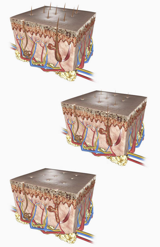 头发,无人,竖图,插画,室内,白天,正面,数码,科技,静物,一排,阴影,整齐,网络,医学,细胞,高光,几何,计算机图形,合成,图画,画,排列,三个,人体,皮肤,电脑合成图,数码合成图,生物学,队列,漫画,生理学,写实,具体,具象,毛囊,脂肪组织,细胞组织,彩图