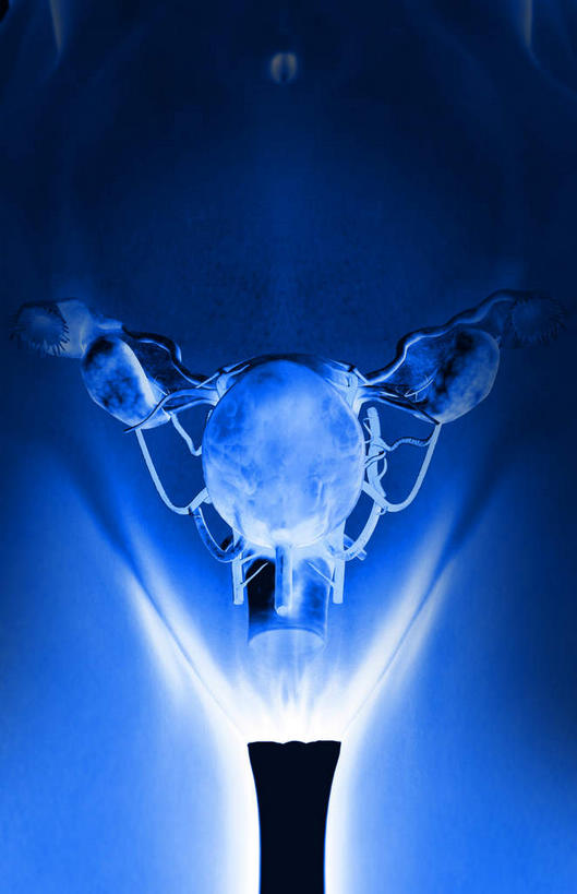 内脏,动脉,静脉,卵巢,子宫,无人,竖图,室内,白天,正面,数码,科技,静物,阴影,黑色背景,网络,医学,高光,几何,计算机图形,合成,蓝色,模型,人体,电脑合成图,数码合成图,疾病,生物学,人体器官,器官,生理学,写实,具体,具象,子宫癌,彩图,生殖器官,子宫颈癌