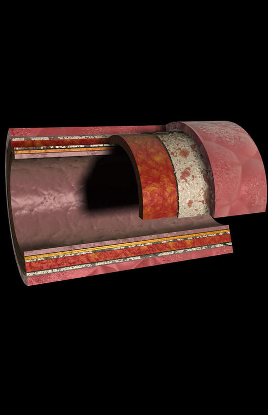 动脉,血管,无人,竖图,插画,室内,特写,白天,正面,数码,科技,静物,阴影,黑色背景,网络,医学,细胞,高光,几何,计算机图形,合成,图画,画,红色,人体,电脑合成图,数码合成图,生物学,漫画,生理学,写实,具体,具象,内膜,彩图,血管壁