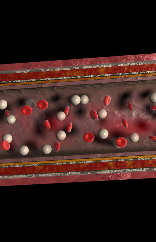 动脉,血管,无人,竖图,插画,室内,特写,白天,正面,数码,科技,静物,阴影,黑色背景,网络,医学,细胞,高光,几何,计算机图形,合成,图画,画,红色,血液,人体,电脑合成图,数码合成图,生物学,血细胞,漫画,白细胞,生理学,写实,具体,具象,红细胞,内膜,彩图,血管壁